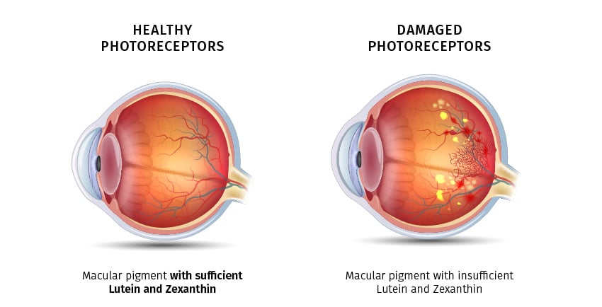 Eye PROtect